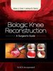 Biologic knee reconstruction : a surgeon’s guide