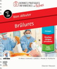 Bien débuter : brûlures