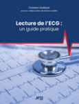 Lecture de l'ECG : un guide pratique