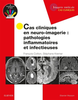 Cas cliniques en neuro-imagerie : pathologies inflammatoires et infectieuses