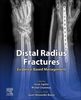 Distal radius fractures : evidence-based management